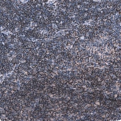 Novus Biologicals Pax5/BSAP Antibody (CL14548), Novus Biologicals 25 &mu;L;