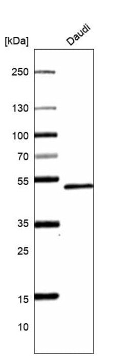 Novus Biologicals Pax5/BSAP Antibody (CL14548), Novus Biologicals 25 &mu;L;