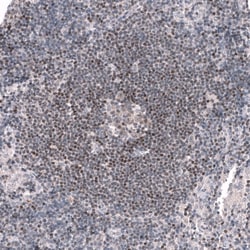 Novus Biologicals Pax5/BSAP Antibody (CL14548), Novus Biologicals 25 &mu;L;