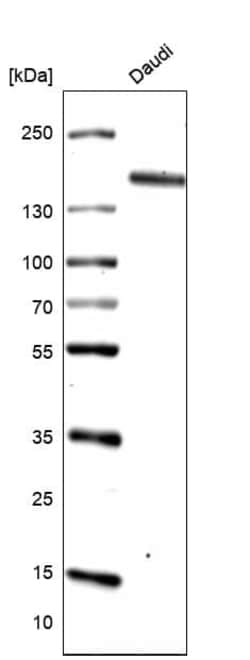 Novus Biologicals CD21 Antibody (CL14552), Novus Biologicals 100 &mu;L;