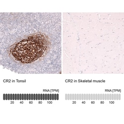 Novus Biologicals CD21 Antibody (CL14552), Novus Biologicals 100 &mu;L;