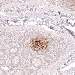 Novus Biologicals CD21 Antibody (CL14552), Novus Biologicals 100 &mu;L;
