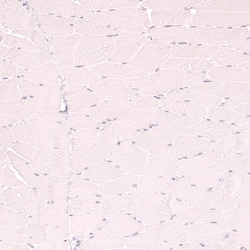 Novus Biologicals CD21 Antibody (CL14552), Novus Biologicals 100 &mu;L;