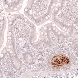 Novus Biologicals CD21 Antibody (CL14556), Novus Biologicals:Antibodies:Primary