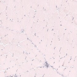 Novus Biologicals CD21 Antibody (CL14556), Novus Biologicals:Antibodies:Primary