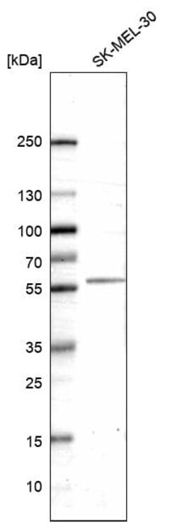 Novus Biologicals 5-HT2B Antibody (CL14576), Novus Biologicals 25 &mu;L;