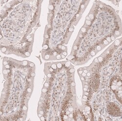 Novus Biologicals Bcl-6 Antibody (CL14611), Novus Biologicals 100 &mu;L;