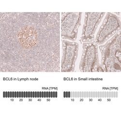 Novus Biologicals Bcl-6 Antibody (CL14611), Novus Biologicals 100 &mu;L;