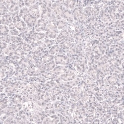 Novus Biologicals Bcl-6 Antibody (CL14612), Novus Biologicals 100 &mu;L;