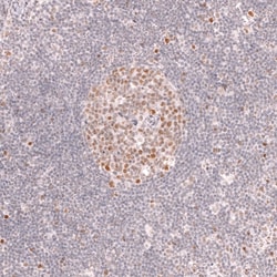 Novus Biologicals Bcl-6 Antibody (CL14612), Novus Biologicals 100 &mu;L;