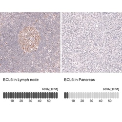 Novus Biologicals Bcl-6 Antibody (CL14612), Novus Biologicals 100 &mu;L;