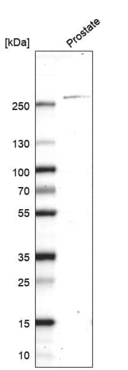 Novus Biologicals Myosin heavy chain 11 Antibody (CL14617), Novus Biologicals:Antibodies:Primary
