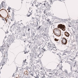 Novus Biologicals Myosin heavy chain 11 Antibody (CL14617), Novus Biologicals:Antibodies:Primary