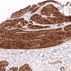 Novus Biologicals Myosin heavy chain 11 Antibody (CL14617), Novus Biologicals:Antibodies:Primary