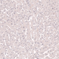 Novus Biologicals Myosin heavy chain 11 Antibody (CL14617), Novus Biologicals:Antibodies:Primary