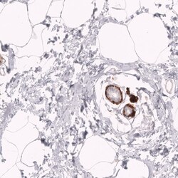 Novus Biologicals Myosin heavy chain 11 Antibody (CL14619), Novus Biologicals:Antibodies:Primary