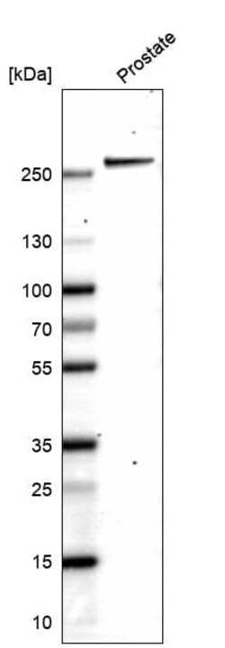 Novus Biologicals Myosin heavy chain 11 Antibody (CL14619), Novus Biologicals:Antibodies:Primary