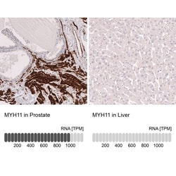 Novus Biologicals Myosin heavy chain 11 Antibody (CL14619), Novus Biologicals:Antibodies:Primary