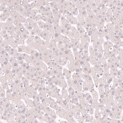 Novus Biologicals Myosin heavy chain 11 Antibody (CL14619), Novus Biologicals:Antibodies:Primary