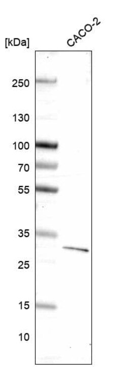 Novus Biologicals Dkk-1 Antibody (CL14707), Novus Biologicals 25 &mu;L;