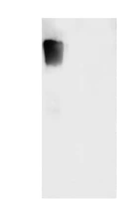 Novus Biologicals Varicella Zoster Virus Glycoprotein E Antibody (15) -