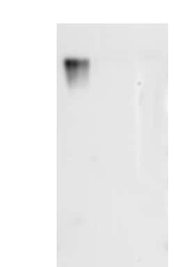 Novus Biologicals Varicella Zoster Virus Glycoprotein E Antibody (17) -