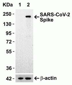 Novus Biologicals SARS-CoV-2 Spike S1 Antibody - BSA Free, Novus Biologicals 0.1 mg | Buy Online | Novus Biologicals&trade; | Fisher Scientific