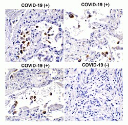 Novus Biologicals SARS-CoV-2 Spike S1 Antibody - BSA Free, Novus Biologicals 0.1 mg | Buy Online | Novus Biologicals&trade; | Fisher Scientific