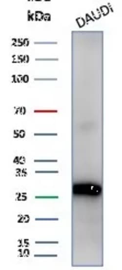 Novus Biologicals Haptoglobin Antibody (HP/4813) - Azide and BSA Free,