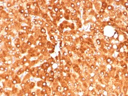 Novus Biologicals Haptoglobin Antibody (HP/4813) - Azide and BSA Free,