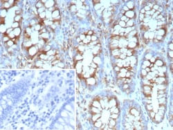 Novus Biologicals Stathmin 1 Antibody (STMN1/9227R) - Azide and BSA Free, Novus Biologicals 100 &mu;g | Buy Online | Novus Biologicals&trade; | Fisher Scientific
