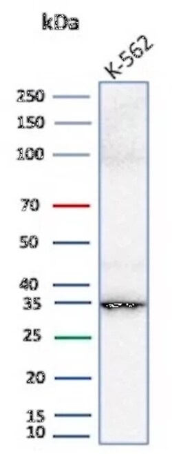 Novus Biologicals Carbonic Anhydrase VIII/CA8 Antibody (CA8/6814) - Azide and BSA Free, Novus Biologicals 100 &mu;g | Buy Online | Novus Biologicals&trade; | Fisher Scientific