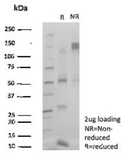 Novus Biologicals ZSCAN5 Antibody (PCRP-ZSCAN5A-2H4) - Azide and BSA Free,
