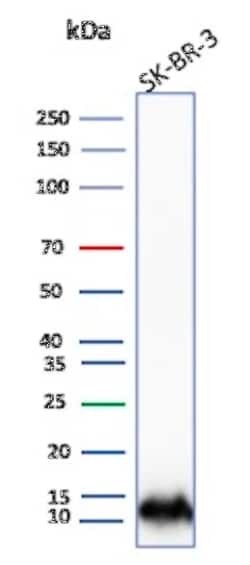 Novus Biologicals S100A16 Antibody (S100A16/7411) - Azide and BSA Free,