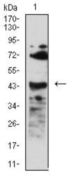 Novus Biologicals BAFFR/TNFRSF13C Antibody (5A9B6), Novus Biologicals 0.1 mL | Buy Online | Novus Biologicals&trade; | Fisher Scientific