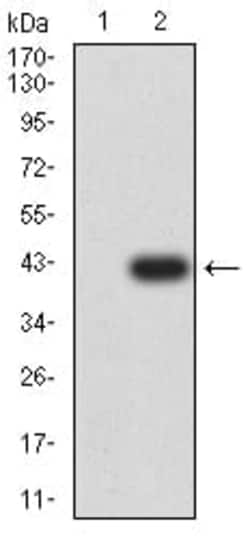 Novus Biologicals Muscarinic Acetylcholine Receptor M5/CHRM5 Antibody (5G3H8),