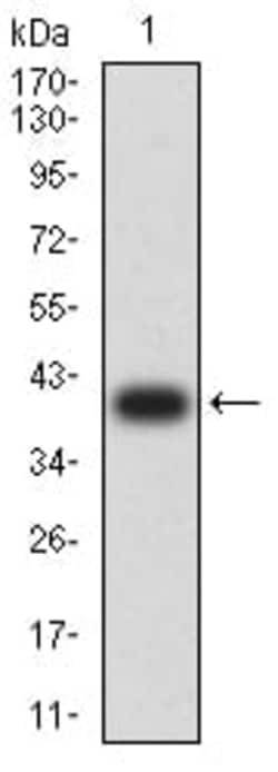 Novus Biologicals VPREB1 Antibody (5F8F3), Novus Biologicals 0.1 mL, Unconjugated:Antibodies,