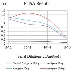 Novus Biologicals KMT2D Antibody (1D10F6), Novus Biologicals 0.1 mL, Unconjugated:Antibodies,