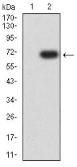 Novus Biologicals Hyaluronan synthase 1 Antibody (2G5H6), Novus Biologicals:Anticorps:Anticorps