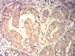 Novus Biologicals SP17 Antibody (3G9F3), Novus Biologicals 0.025 mL, Unconjugated:Antibodies,