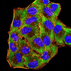 Novus Biologicals Gr-1/Ly-6G Antibody (3D6E10), Novus Biologicals 0.1 mL,