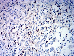 Novus Biologicals TRBC1 Antibody (5A8A10), Novus Biologicals:Antibodies:Primary