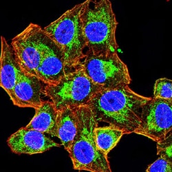 Novus Biologicals Hyaluronan synthase 1 Antibody (5B5B4), Novus Biologicals:Antibodies:Primary