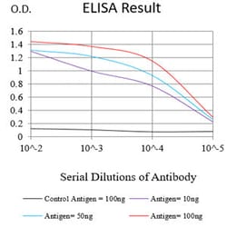 Novus Biologicals Hyaluronan synthase 1 Antibody (5B5B4), Novus Biologicals:Antibodies:Primary