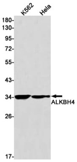 Novus Biologicals ALKBH4 Antibody (SR2366), Novus Biologicals 100 &mu;L;
