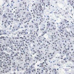 Novus Biologicals CXXC1 Antibody (SR2392), Novus Biologicals 100 &mu;L | Buy Online | Novus Biologicals&trade; | Fisher Scientific