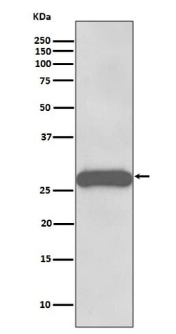 Novus Biologicals Protein Phosphatase inhibitor 1 Antibody (SR3103), Novus