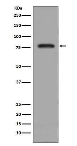 Novus Biologicals PKC beta 2 Antibody (SR2824), Novus Biologicals:Antibodies:Primary