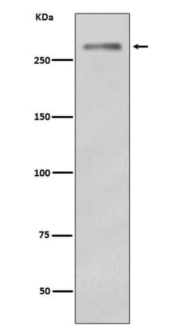 Novus Biologicals Dysferlin Antibody (SR2944), Novus Biologicals:Antibodies:Primary