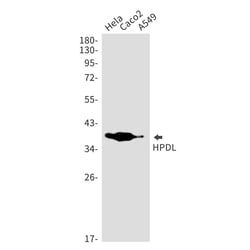 Novus Biologicals HPDL Antibody (SR2424), Novus Biologicals 100 &mu;L | Buy Online | Novus Biologicals&trade; | Fisher Scientific